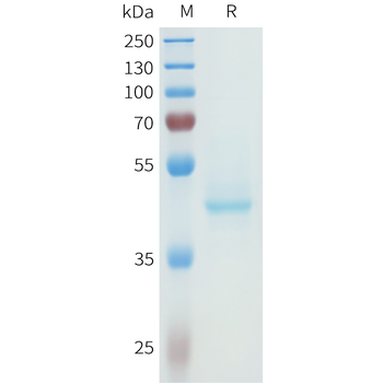 Mouse GIPR Protein, hFc Tag