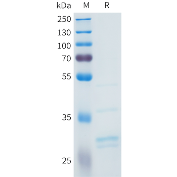 Mouse CCR2 Protein, hFc Tag