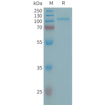 Human FCRL5(745-847)Protein, mFc Tag