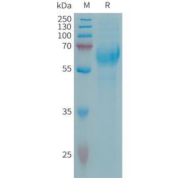 Human FCRL5(745-850)Protein, hFc Tag