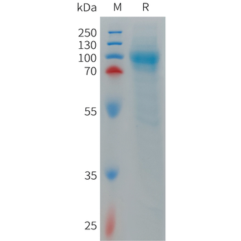 Human XCR1 Protein, hFc Tag