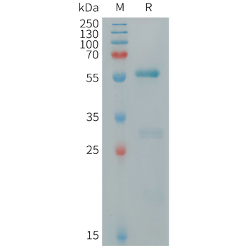 Human BAMBI Protein, hFc Tag