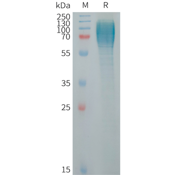 Human ADAM17(581-642) Protein, mFc Tag