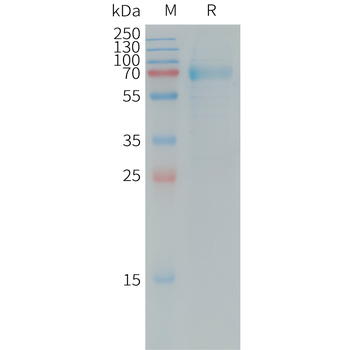 Human KLK1 Protein, His Tag