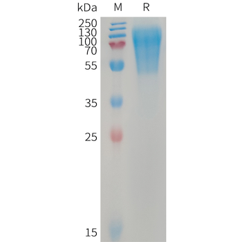 Human SAP Protein, His Tag