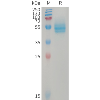Human FCN1 Protein, His Tag
