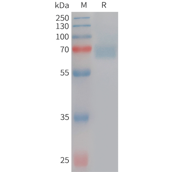 Human FCRL5(752-834) Protein, hFc Tag