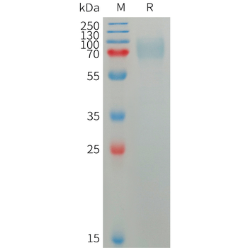 Human RAMP1 Protein, mFc Tag