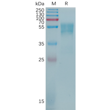 Human MADCAM1 Protein, His Tag