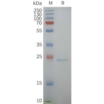 Human AQP5 full length protein-synthetic nanodisc