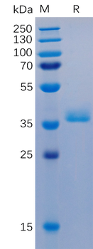 Mouse SLITRK6 Protein, His Tag