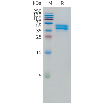Canine IL31 Protein, His Tag