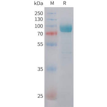 Cynomolgus ROR2 Protein, N-His Tag