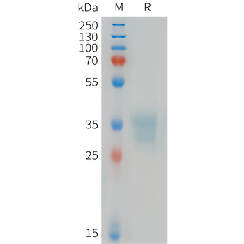 Cynomolgus MUC1(254-373) Protein, His Tag