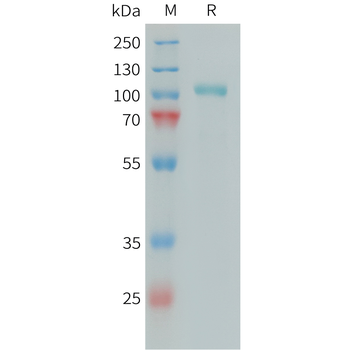 Human MSP2N2 Protein, His Tag