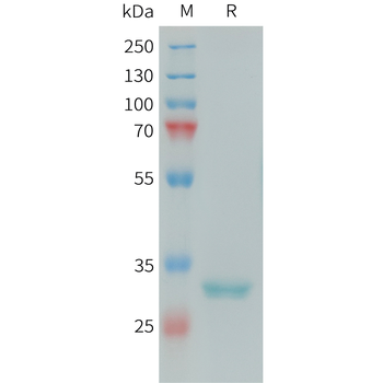 Human MSP1D1(del H5) Protein, His Tag