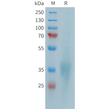 Human ROR2(34-168) Protein, hFc Tag