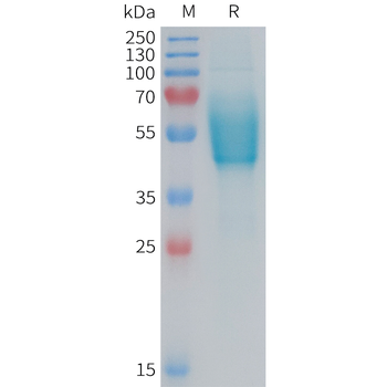 Human AXL(129-226) Protein, hFc Tag