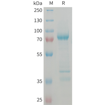 Human AXL(26-92) Protein, hFc Tag