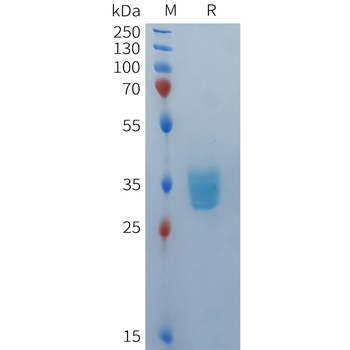 Human ROR1(148-311) Protein, hFc Tag