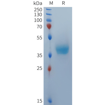 Human ROR1(30-164) Protein, hFc Tag