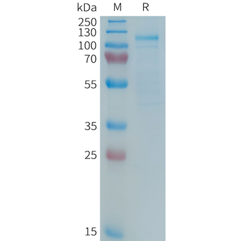 Human B7-H4(147-259) Protein, hFc Tag