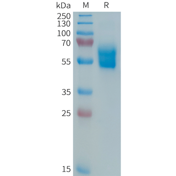 Human CEACAM5(496-592) Protein, hFc Tag