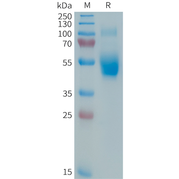 Human CEACAM5(411-500) Protein, hFc Tag