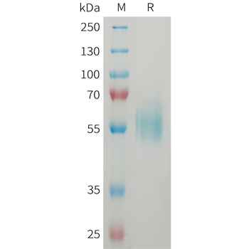 Human CEACAM5(35-144) Protein, hFc Tag
