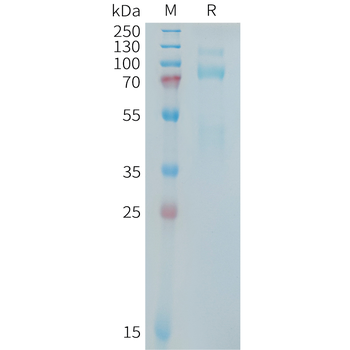 Human CDH17(450-566) Protein, hFc Tag
