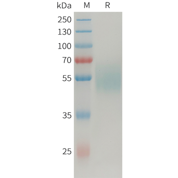 Human CDH17(245-340) Protein, hFc Tag