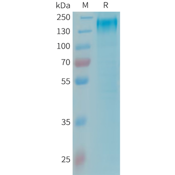 Human AKT1(409-480) Protein, hFc Tag