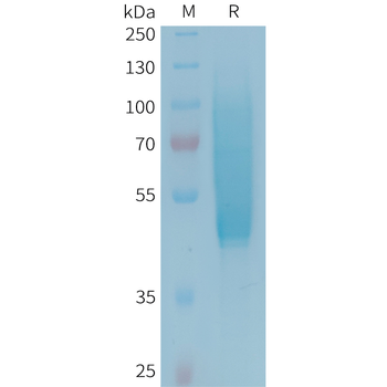 Human ACVR2B Protein, hFc Tag