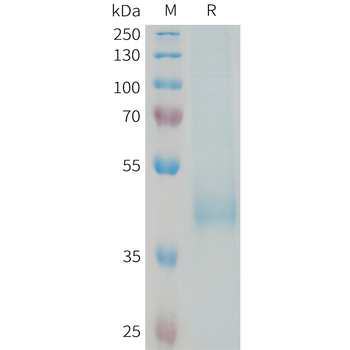 Human CADM1 Protein, hFc Tag