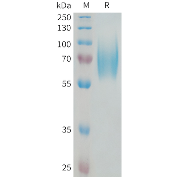 Human MMP9(32-488) Protein, hFc Tag
