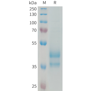 Human CLEC1A Protein, His Tag