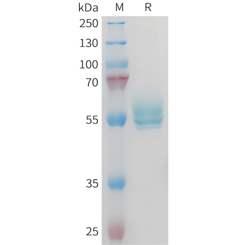 Human ALPL Protein, His Tag