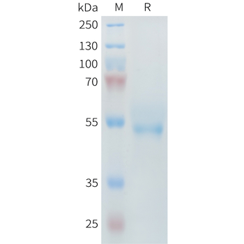 Human ALPI Protein, His Tag