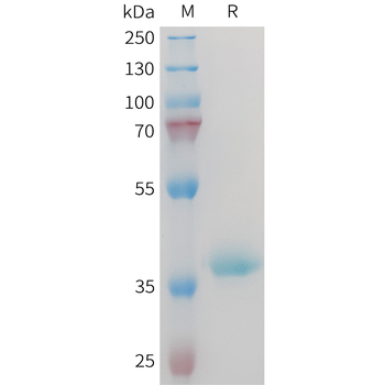 Human STEAP1 Protein, hFc Tag