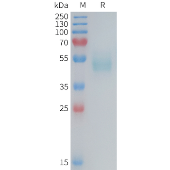 Human CFD Protein, His Tag