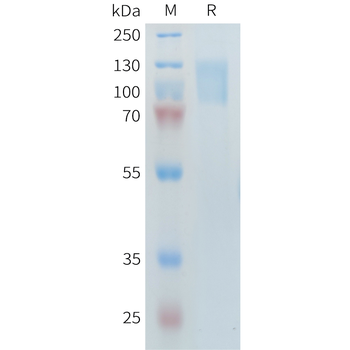 Human B4GALT1 Protein, His Tag