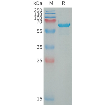 Human DLL3(311-492) Protein, hFc Tag