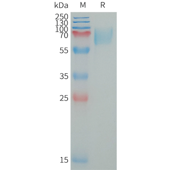 Human CA12 Protein, His Tag