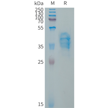 Human DLL3(390-492) Protein, hFc Tag