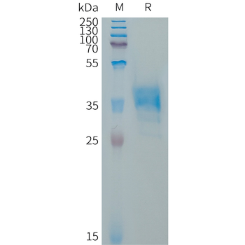 Human DLL3(352-492) Protein, hFc Tag