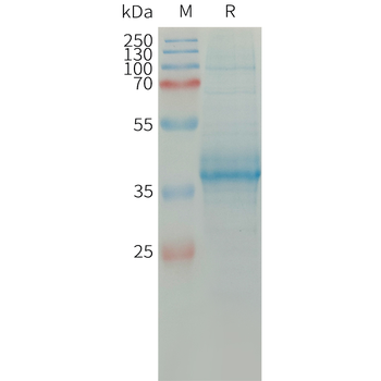 Human NKG2C Protein, hFc Tag