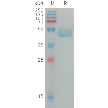 Human HE4 Protein, hFc Tag