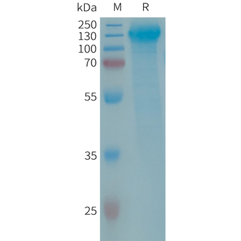 Human CD105 Protein, His Tag