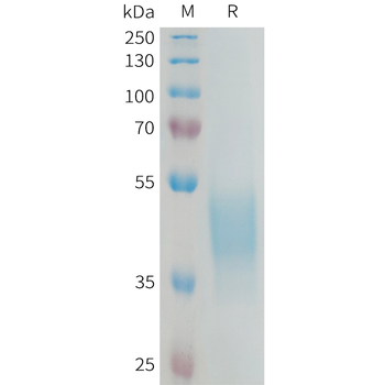 Human CCL22 Protein, hFc Tag