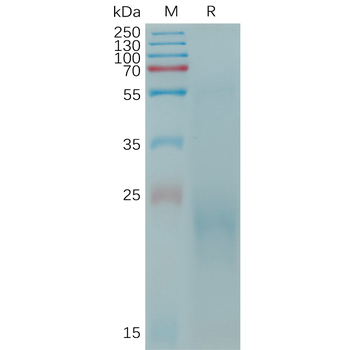 Human APLNR Protein, hFc Tag